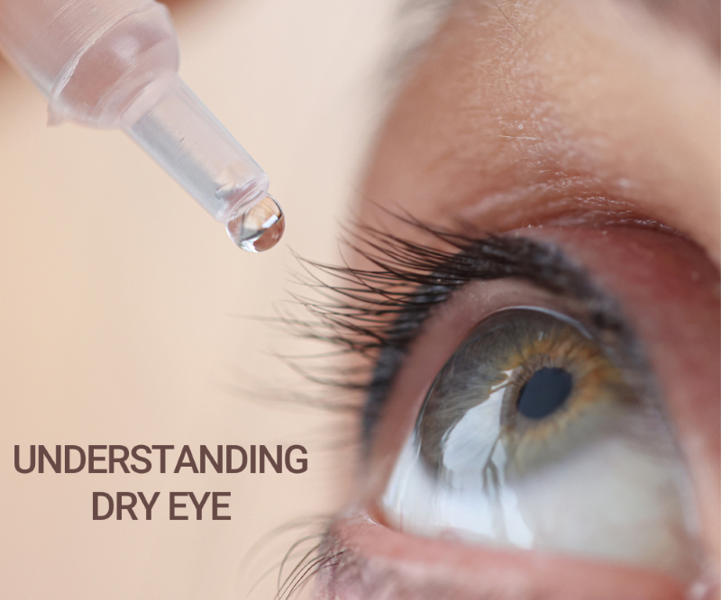 Understanding Dry Eye